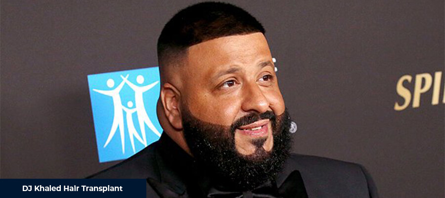 DJ Khaled Hair Transplant