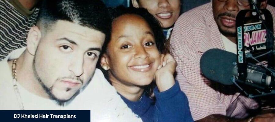 DJ Khaled Hair Transplant