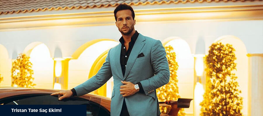 Tristan Tate Saç Ekimi Yolculuğu 1 Tristan Tate Saç Ekimi Yolculuğu