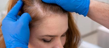 hair-fungus-treatment