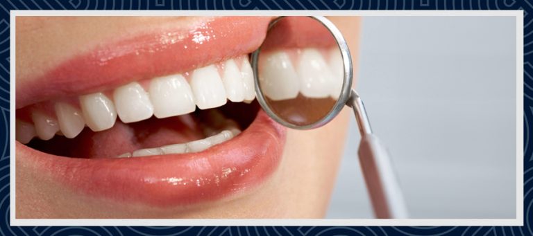 Composite Bonding i Tyrkiet