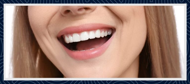 Hollywood Smile Turkiet