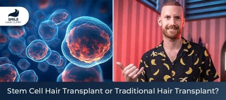 Stem-Cell-Hair-Transplant-or-Traditional-Hair-Transplant-