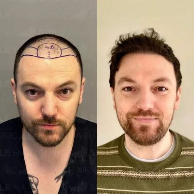 3050 Grafts - C. MCLEISTER