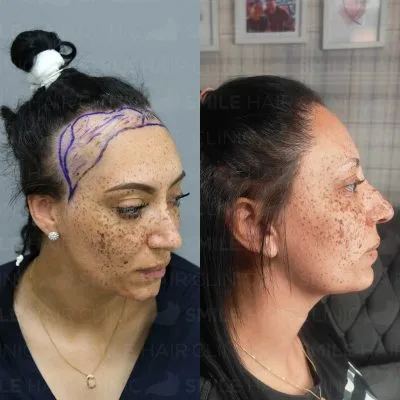 3200 Grafts - T. WOODCOCK