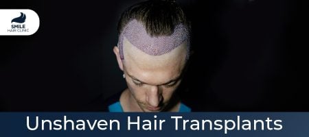 Unshaven-Hair-Transplants