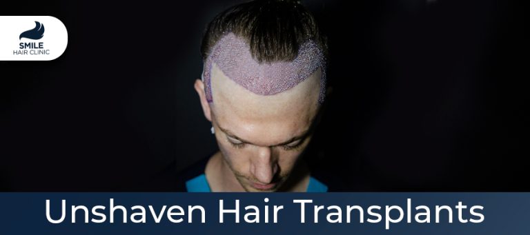 unshaven hair transplants