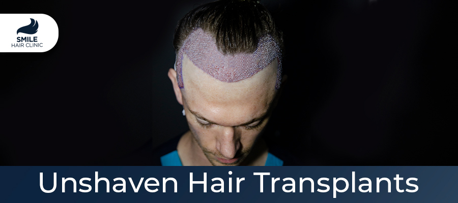 unshaven hair transplants
