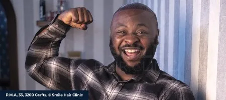 Afro-Hair-Transplant-02-1