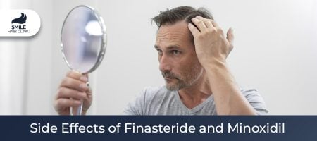 Side Effects of Finasteride and Minoxidil