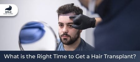 What is the Right Time to get a Hair Transplant