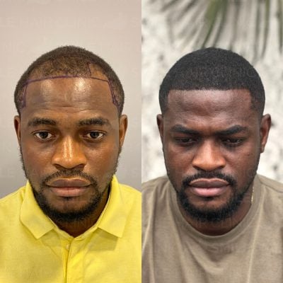 1800 Grafts - S. MAGBUTU