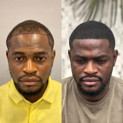 1800 Grafts - S. MAGBUTU