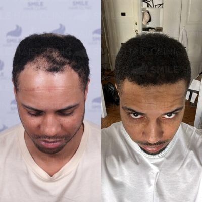 3850 Grafts - C. DOWLING