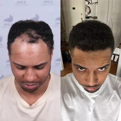 3850 Grafts - C. DOWLING