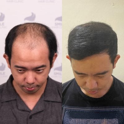 4000 Graft - T. MANERO