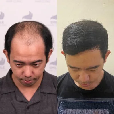 4000 Graft - T. MANERO