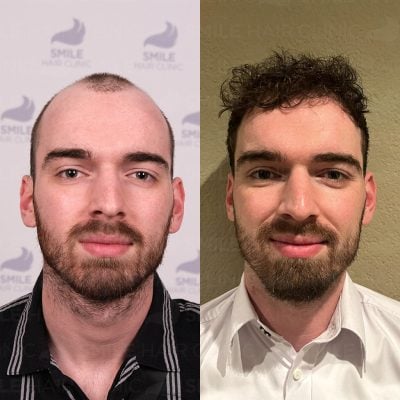 4000 Grafts - G. V. KOLK