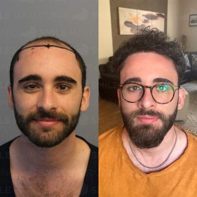 4600 Grafts- C. VELLA