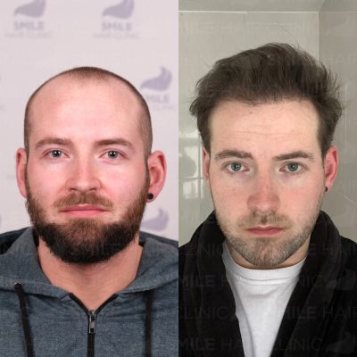 4900 Grafts - C. DOWLING