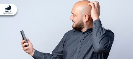 COVID-19-saç-dökülmesine-neden-olur-mu-