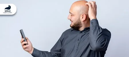 COVID-19-saç-dökülmesine-neden-olur-mu-