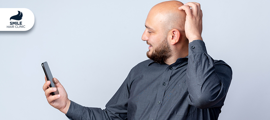 COVID-19 Saç Dökülmesine Neden Olur Mu?