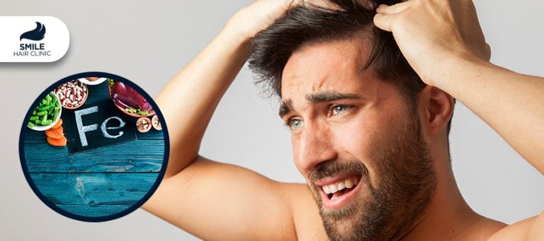 Anemia Por Deficiência De Ferro E Perda De Cabelo