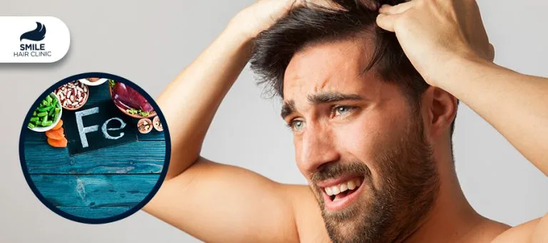 Iron Deficiency Anemia and Hair Loss