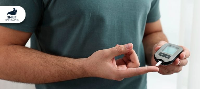 A mund të bëjnë transplantin e flokëve diabetikët?