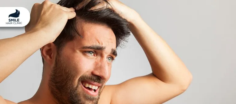 Выпадение волос и дигидротестостерон (ДГТ)