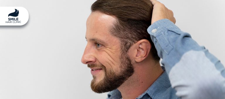 Do Wigs Cause Hair Loss?