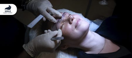 How Does an Eyebrow Transplant Work_