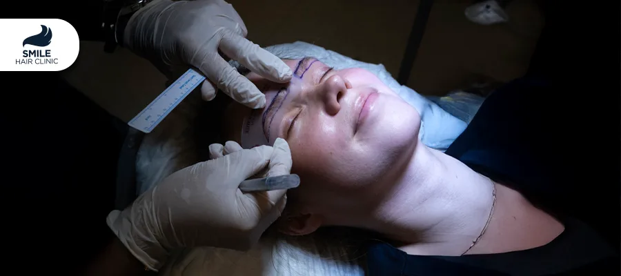 Eyebrow Transplant