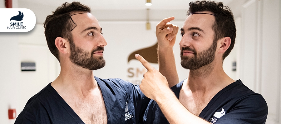 How to Stop Receding Hairline: Treatments & What Works