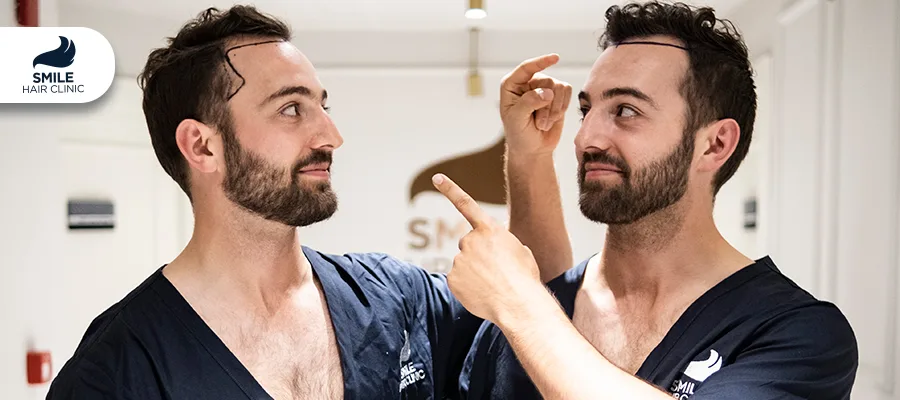 How to Stop Receding Hairline: Treatments & What Works 8 How to Stop Receding Hairline: Treatments & What Works