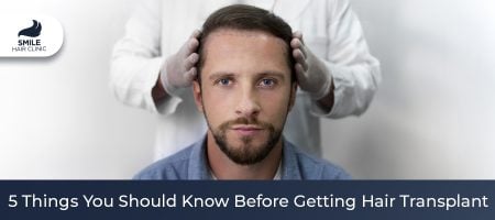 5-Things-You-Should-Know-Before-Getting-Hair-Transplant