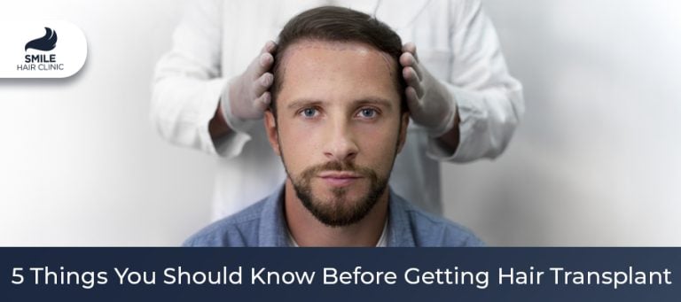 You Should Know Before Getting a Hair Transplant