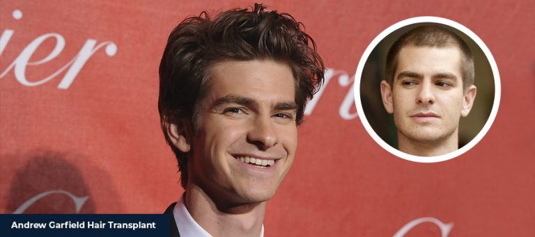 Andrew Garfield Saç Ekimi