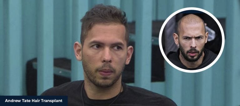 Andrew Tate Saç Ekimi