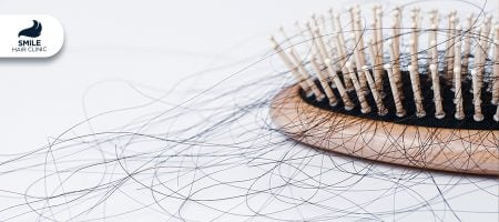 Anorexia-Malnutrition-Strict-Diets-and-hair-loss