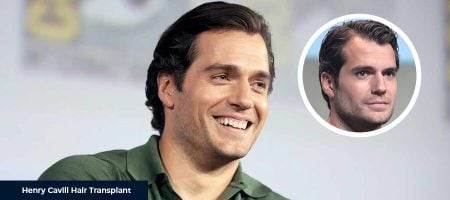 Before-After-Henry-Cavill