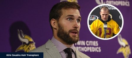 Before-After-Kirk-Cousins-1
