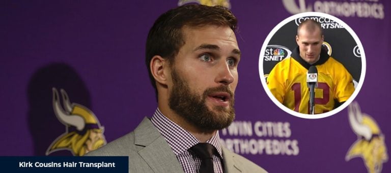 Kirk Cousins ​​Saç Ekimi