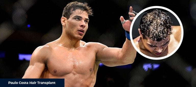 Paulo Costa Saç Ekimi