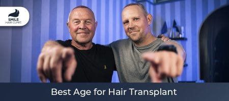 Best-Age-for-Hair-Transplant