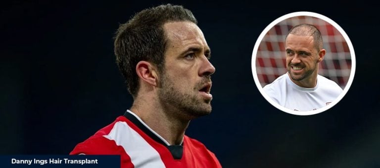 Danny Ings Saç Ekimi