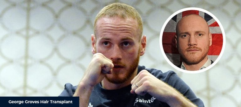 George Groves Saç Ekimi