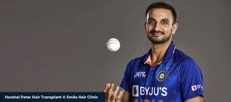 Harshal-Patel-Hair-Transplant-02