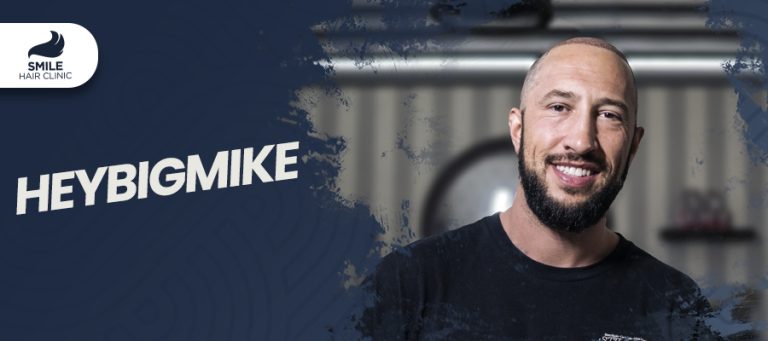 Mike’s Hair Transplant Journey